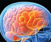 Higher Vitamin K Levels Associated With Improved Verbal Episodic Memory