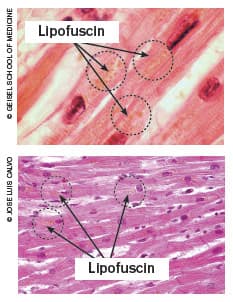 Visualisatie van cellen met lipofuscine bij hartweefsel