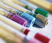 Need For Choline Higher In Some Individuals