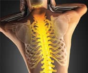 Deficient Levels Of Vitamin D Associated With Compromised Immune Function