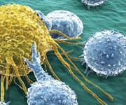 Grape Seed Compound Demonstrates Anticancer Effect In Prostate Cancer Cells