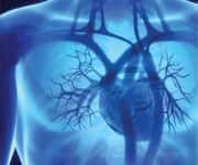 Higher Vitamin C Levels, Intake Linked With Lower Risk Of Stroke