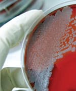 Probiotics And Chronic Disease