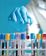 CRP Predicts Heart Disease and Cancer Risk