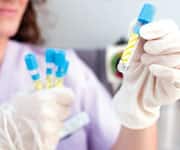 What Are Optimal CRP Levels?