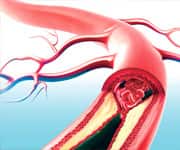 The Importance Of Endothelial Health