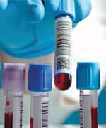 Expanding Roles And Mechanisms Of Probiotics’ Widespread Actions