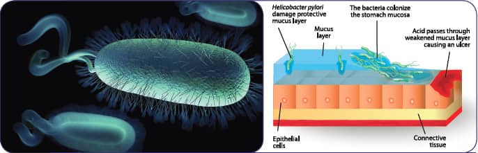 Protecting Stomach Tissue From Excess Acid Production