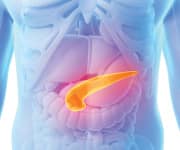 Metformin Plus Aspirin Inhibit Pancreatic Cancer