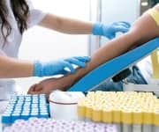 Blood Sugar And Tissue Damage