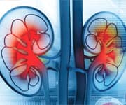 Benfotiamine Inhibits Sugar-Related Kidney Disease