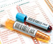 CoQ10 Treats And Prevents Heart Disease