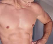 No Link Between Calcium Supplements And Coronary Artery Calcification In Rheumatoid Arthritis Patients