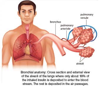 What you need to know