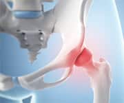 Tart Cherry Juice Could Help Improve Joint Symptoms