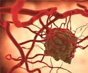 Curcumin Quiets Crosstalk In Tumor Cellular Environment