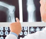 Resveratrol Shows Bone Benefit