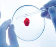 Low-Dose Aspirin Linked To Decreased Blood Clot Risk