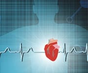 Systemic Calcification