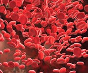 No Link Between Calcium Supplements And Coronary Artery Calcification In Rheumatoid Arthritis Patients