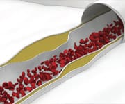 Interpreting Your Test Results