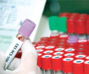 DHEA Fights Cardiovascular Disease