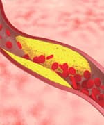 Safely Control Cholesterol 