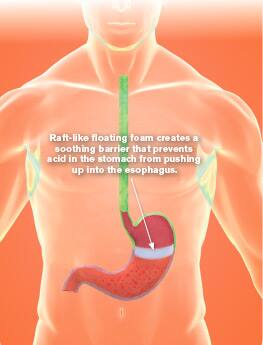 Among good choices are