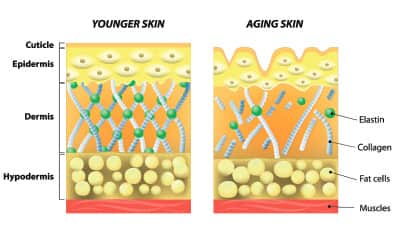 The Keratin Connection