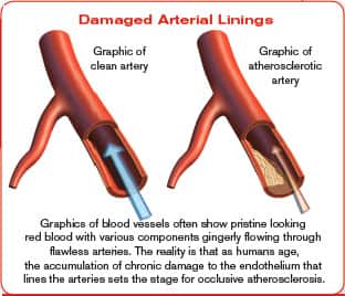Urgent Need to Increase Plaque Stability