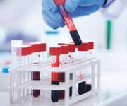 What Is a Pack-Year?