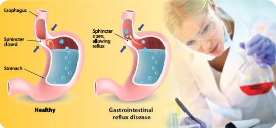 Smoking’s Impact on the Kidneys