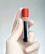 Mean Percentage Change in
Serum Uric Acid Levels by Treatment Agent