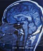 PQQ Reduces Harmful Neuroinflammation