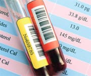 What Are Optimal Triglyceride Readings?