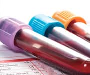 Urgent Need to Test Blood of Younger People