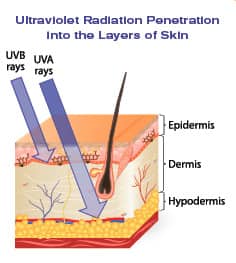 Skin Cancer SurgeryHow To Reduce Scarring and Pain