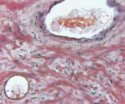 Delineating the PSA Quandary