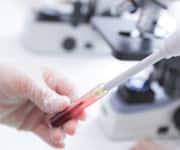 Findings from 10-Year Study Using Focal Ablation Therapy