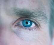 Higher Vitamin C Intake Helps Slow Cataract Progression