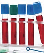 Traumatic Brain Injury Neurosteroid Test Panel