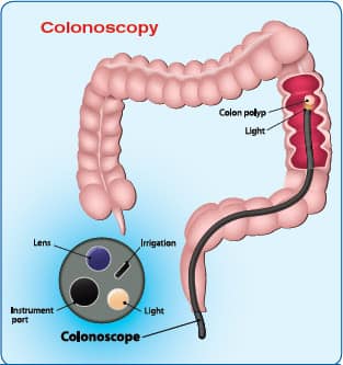 Government Inflicted Colon Cancer