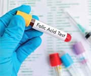 What is Homocysteine?