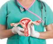 Metformin Lowers Mortality Risk in Diabetic Women with Cervical Cancer