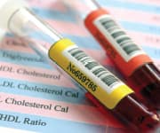 The Benefits of Extra Virgin Olive Oil