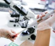 Delay in Curing Scurvy