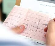 What you need to know