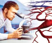 Preventing Venous Thromboses