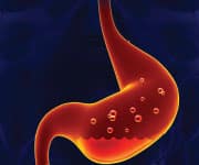 Gastric acid in the stomach