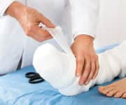 Bone Fracture and Stroke Risks